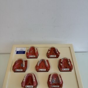 Go Dent Schaumodelle 1-7 Modellset Patienteninformation Art. Nr. GO-2 Gold Zähne